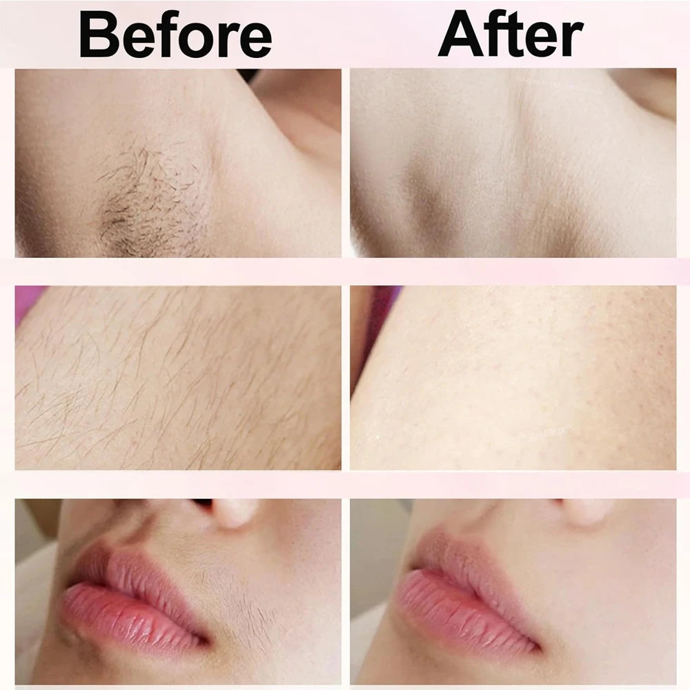 BabeEdge™ Bikini Line Shaver
