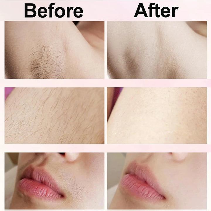 BabeEdge™ Bikini Line Shaver